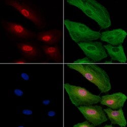 Invitrogen H3F3A Polyclonal Antibody 100 &mu;L; Unconjugated:Antibodies,