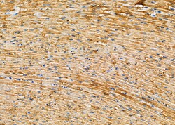 Invitrogen SULT1A4 Polyclonal Antibody 100 &mu;L; Unconjugated:Antibodies,