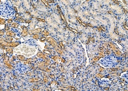 Invitrogen SULT1A4 Polyclonal Antibody 100 &mu;L; Unconjugated:Antibodies,