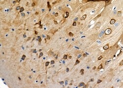 Invitrogen Lysozyme Polyclonal Antibody 100 &mu;L; Unconjugated:Antibodies,