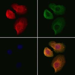 Invitrogen Hemoglobin Polyclonal Antibody 100 &mu;L; Unconjugated:Antibodies,