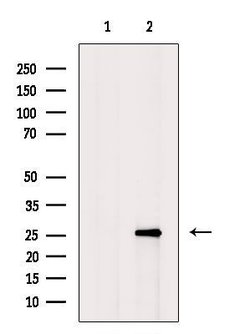 Invitrogen Hemoglobin Polyclonal Antibody 100 &mu;L; Unconjugated:Antibodies,