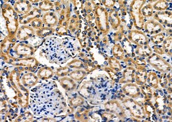 Invitrogen PUM1 Polyclonal Antibody 100 &mu;L; Unconjugated:Antibodies,