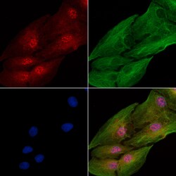Invitrogen PHD1 Polyclonal Antibody 100 &mu;L; Unconjugated:Antibodies,