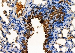 Invitrogen hCG beta-2 Polyclonal Antibody 100 &mu;L; Unconjugated:Antibodies,