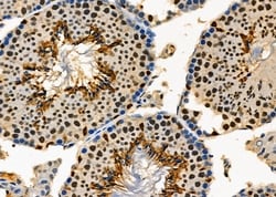 Invitrogen PCYT1A Polyclonal Antibody 100 &mu;L; Unconjugated:Antibodies,
