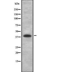 Invitrogen PCYT1A Polyclonal Antibody 100 &mu;L; Unconjugated:Antibodies,