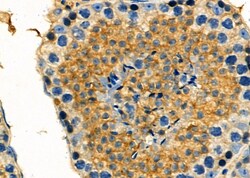 Invitrogen EHD1 Polyclonal Antibody 100 &mu;L; Unconjugated:Antibodies,