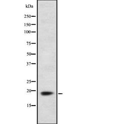 Invitrogen FDX1 Polyclonal Antibody 100 &mu;L; Unconjugated:Antibodies,