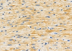 Invitrogen GluR4 Polyclonal Antibody 100 &mu;L; Unconjugated:Antibodies,