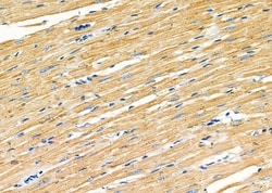 Invitrogen GluR4 Polyclonal Antibody 100 &mu;L; Unconjugated:Antibodies,