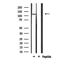 Invitrogen GluR4 Polyclonal Antibody 100 &mu;L; Unconjugated:Antibodies,