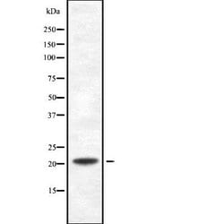 Invitrogen PDCD6 Polyclonal Antibody 100 &mu;L | Buy Online | Invitrogen&trade; | Fisher Scientific