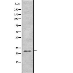 Invitrogen ARFRP1 Polyclonal Antibody 100 &mu;L; Unconjugated:Antibodies,