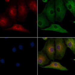 Invitrogen Calsequestrin 2 Polyclonal Antibody 100 &mu;L; Unconjugated:Antibodies,