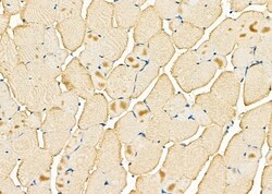 Invitrogen Calsequestrin 2 Polyclonal Antibody 100 &mu;L; Unconjugated:Antibodies,