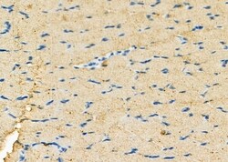 Invitrogen Calsequestrin 2 Polyclonal Antibody 100 &mu;L; Unconjugated:Antibodies,
