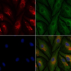 Invitrogen KATNA1 Polyclonal Antibody 100 &mu;L | Buy Online | Invitrogen&trade; | Fisher Scientific
