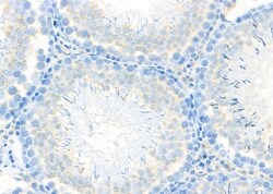 Invitrogen KATNA1 Polyclonal Antibody 100 &mu;L | Buy Online | Invitrogen&trade; | Fisher Scientific