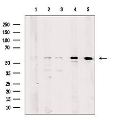 Invitrogen KATNA1 Polyclonal Antibody 100 &mu;L | Buy Online | Invitrogen&trade; | Fisher Scientific