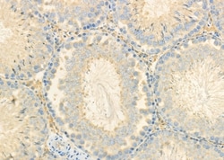 Invitrogen CEACAM6 Polyclonal Antibody 100 &mu;L; Unconjugated:Antibodies,