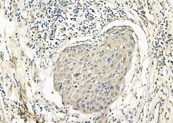 Invitrogen CLSTN1 Polyclonal Antibody 100 &mu;L | Buy Online | Invitrogen&trade; | Fisher Scientific