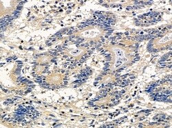 Invitrogen ATG4A Polyclonal Antibody 100 &mu;L | Buy Online | Invitrogen&trade; | Fisher Scientific