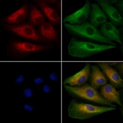 Invitrogen PTP4A2 Polyclonal Antibody 100 &mu;L; Unconjugated:Antibodies,