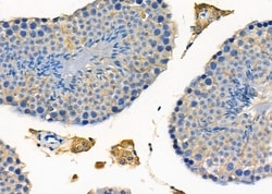 Invitrogen PTP4A2 Polyclonal Antibody 100 &mu;L; Unconjugated:Antibodies,