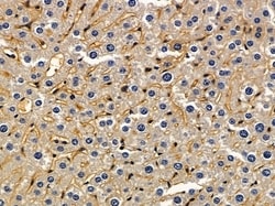 Invitrogen TRIP10 Polyclonal Antibody 100 &mu;L | Buy Online | Invitrogen&trade; | Fisher Scientific