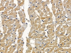 Invitrogen TRIP10 Polyclonal Antibody 100 &mu;L | Buy Online | Invitrogen&trade; | Fisher Scientific