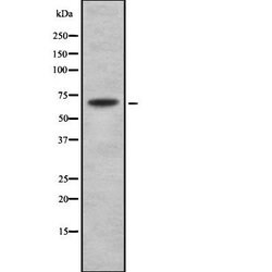 Invitrogen TRIP10 Polyclonal Antibody 100 &mu;L | Buy Online | Invitrogen&trade; | Fisher Scientific