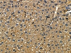Invitrogen GRB7 Polyclonal Antibody 100 &mu;L; Unconjugated:Antibodies,