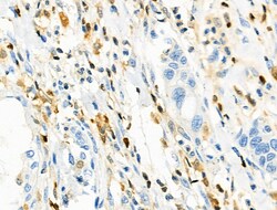 CD3g Polyclonal Antibody:Antibodies, Polyclonal