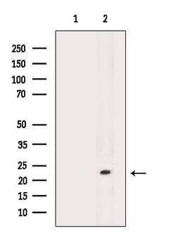 Invitrogen CLEC3B Polyclonal Antibody 100 &mu;L; Unconjugated:Antibodies,