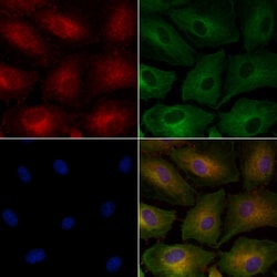 Invitrogen Renalase Polyclonal Antibody 100 &mu;L; Unconjugated:Antibodies,
