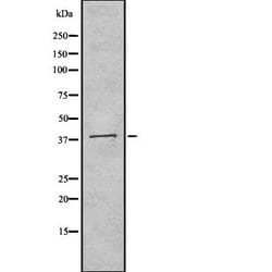 Invitrogen Biglycan Polyclonal Antibody 100 &mu;L; Unconjugated:Antibodies,