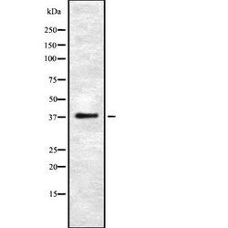 UCH37 Polyclonal Antibody, Invitrogen 100 &mu;L; Unconjugated:Antibodies,