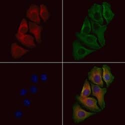 Invitrogen p39 Polyclonal Antibody 100 &mu;L; Unconjugated:Antibodies,