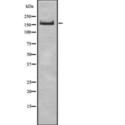 UGGT1 Polyclonal Antibody:Antibodies, Polyclonal