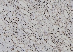 Invitrogen HDLBP Polyclonal Antibody 100 &mu;L | Buy Online | Invitrogen&trade; | Fisher Scientific