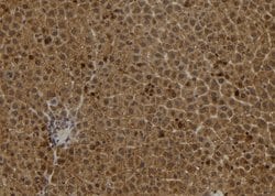 Invitrogen S100A2 Polyclonal Antibody 100 &mu;L | Buy Online | Invitrogen&trade; | Fisher Scientific