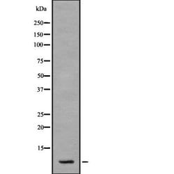 Invitrogen S100A2 Polyclonal Antibody 100 &mu;L | Buy Online | Invitrogen&trade; | Fisher Scientific