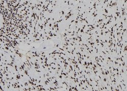Invitrogen DUSP3 Polyclonal Antibody 100 &mu;L; Unconjugated:Antibodies,