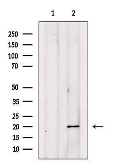 Invitrogen DUSP3 Polyclonal Antibody 100 &mu;L; Unconjugated:Antibodies,
