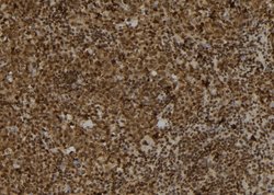 Invitrogen TRAM2 Polyclonal Antibody 100 &mu;L | Buy Online | Invitrogen&trade; | Fisher Scientific