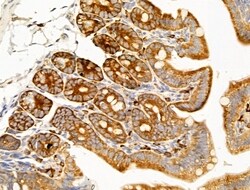 Invitrogen TRAM2 Polyclonal Antibody 100 &mu;L | Buy Online | Invitrogen&trade; | Fisher Scientific