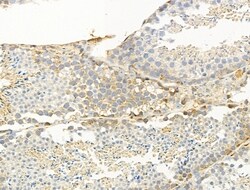 Invitrogen TRAM2 Polyclonal Antibody 100 &mu;L | Buy Online | Invitrogen&trade; | Fisher Scientific