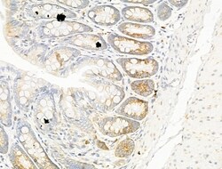 Invitrogen TRAM2 Polyclonal Antibody 100 &mu;L | Buy Online | Invitrogen&trade; | Fisher Scientific