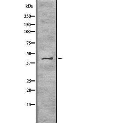 Invitrogen TRAM2 Polyclonal Antibody 100 &mu;L | Buy Online | Invitrogen&trade; | Fisher Scientific